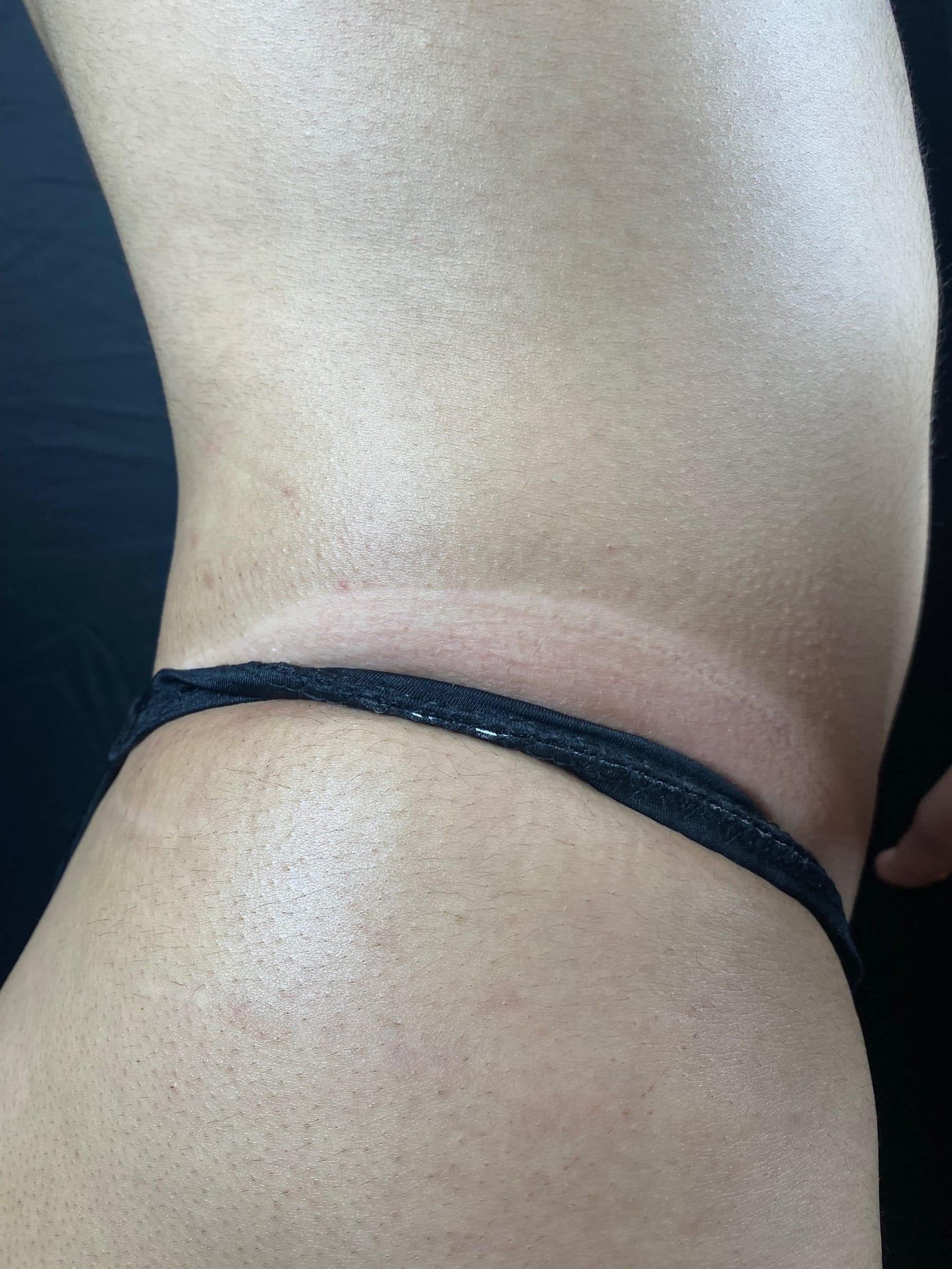 Close-up comparison of natural skin and spray tan color